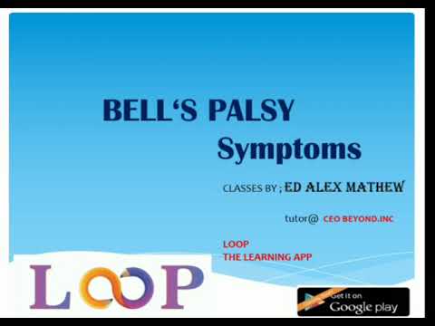 BELLS PALSY