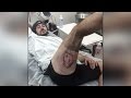 iPhone exploded in man's pocket giving him horrific burns, See pic