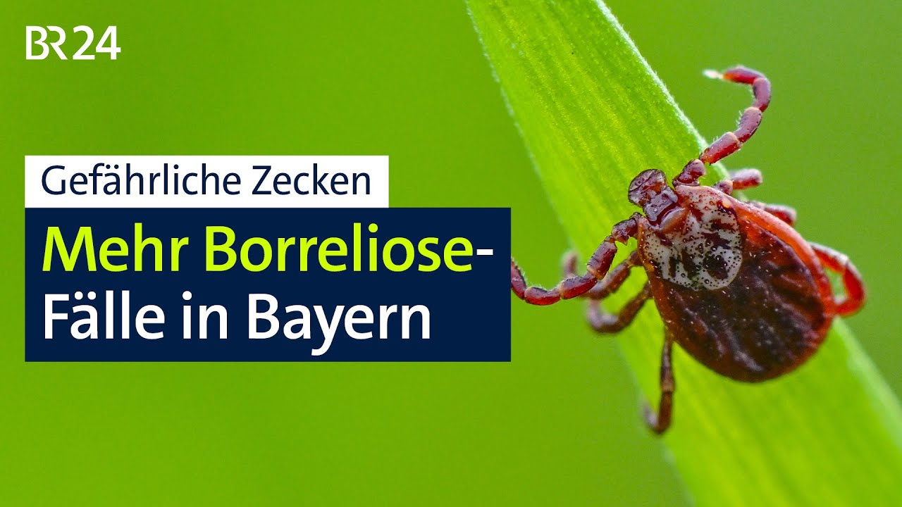 Gefährliche Zecken: Mehr Borreliose-Fälle in Bayern | BR24