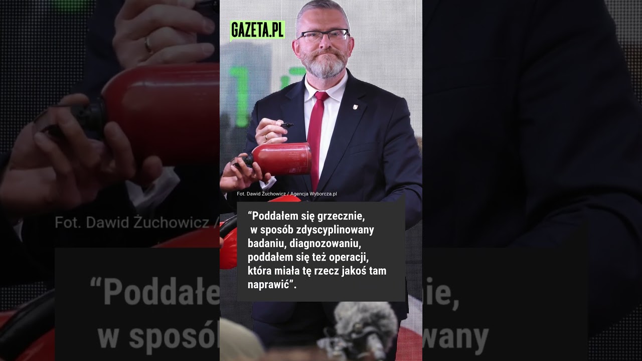 Braun z tajemniczą opaską na oku. Co się stało? #shorts