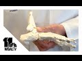Foot surgeon explains how to treat nagging heel pain