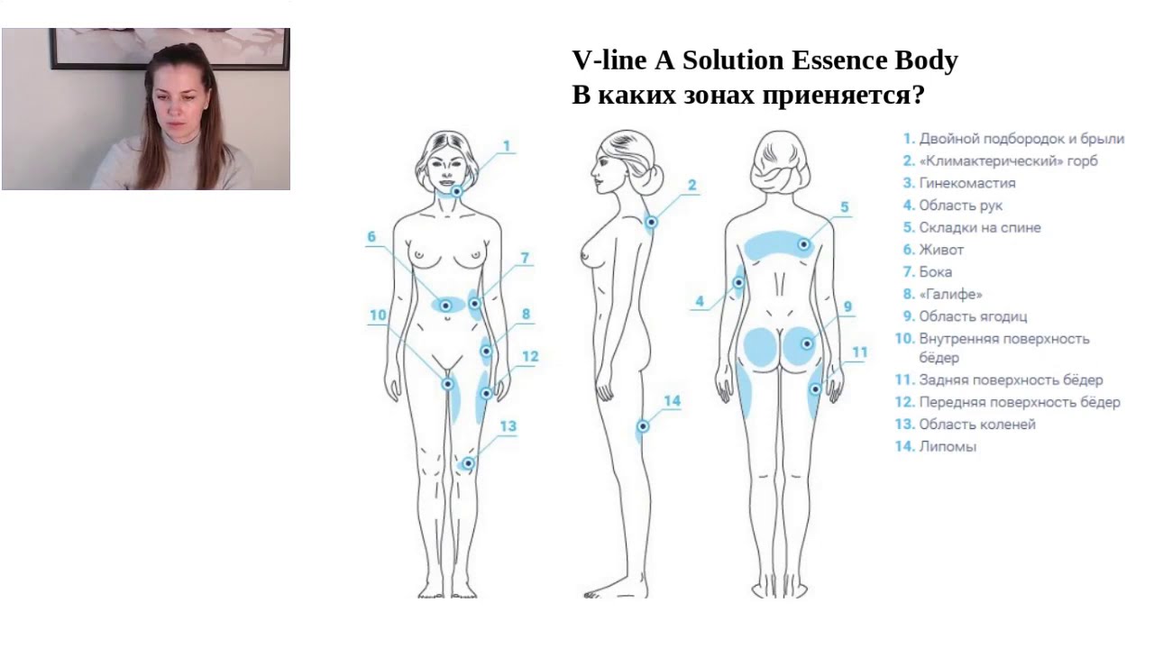 Зоны липолитиков. Схемы введения липолитиков. Схема уколов липолитиков бедра. Коррекция контуров тела. Схема введения липолитика на спине.