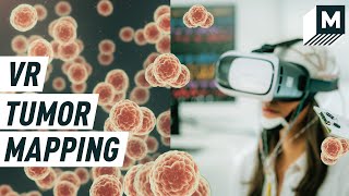 How VR Is Changing How We Look at Tumors | Mashable