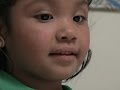 AP : Brainstem Implants Help Deaf Children Hear