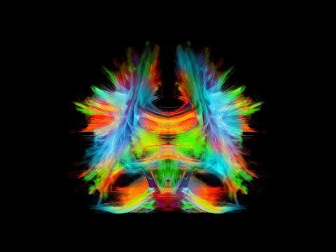Nouvelle Chaire de recherche en neuroinformatique à l’Université de Sherbrooke | Propulser la connaissance du cerveau. Cette nouvelle chaire sera dirigée par le professeur-chercheur Maxime Descoteaux, du Département d’informatique de la Faculté des sciences de l’UdeS et du Centre de recherche du CHUS. Nouvelle Chaire de recherche en neuroinformatique à l’Université de Sherbrooke | Propulser la connaissance du cerveau. Cette nouvelle chaire sera dirigée par le professeur-chercheur Maxime Descoteaux, du Département d’informatique de la Faculté des sciences de l’UdeS et du Centre de recherche du CHUS.