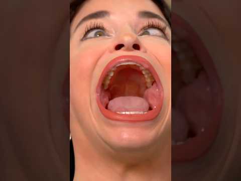 Big Dental Fails !?