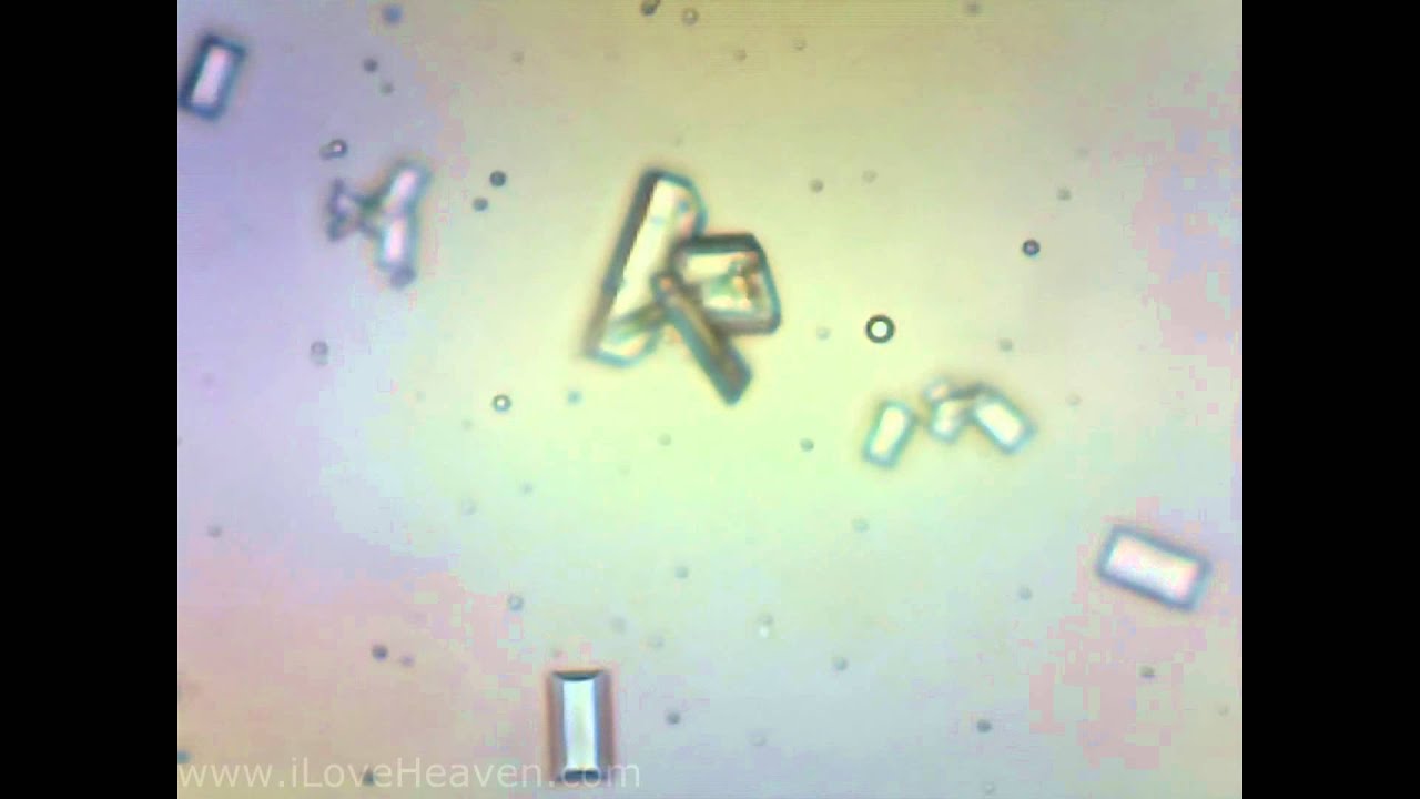 feline-urine-sample-with-struvite-crystals-4-microscope-camera-youtube