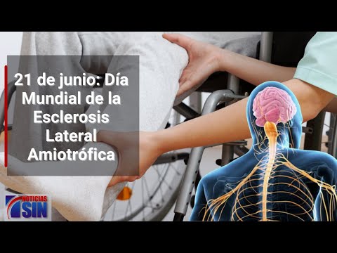 21 de junio: Día Mundial de la Esclerosis Lateral Amiotrófica