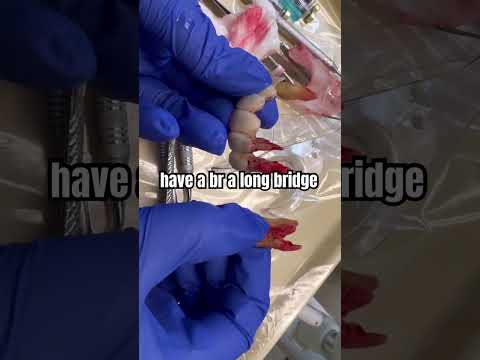 Not Seeing Dentist Regularly and Not Doing Oral Hygiene Daily Consequences