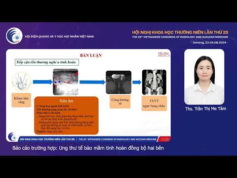 5. Báo cáo trường hợp: Ung thư tế bào mầm tinh hoàn đồng bộ hai bên (ThS. Trần Thị Me Tâm)