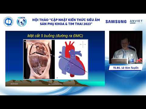 Siêu âm tim thai: cập nhật khuyến cáo 2023 của ISUOG và ASE (TS.BS. Lê Kim Tuyến)