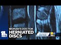 Women more prone to herniated discs, study finds