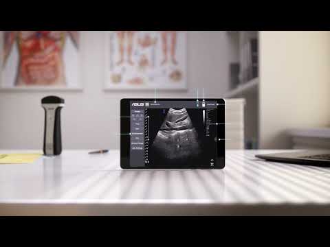 ASUS LU700 Portable Ultrasound Series- Fast and reliable medical imaging