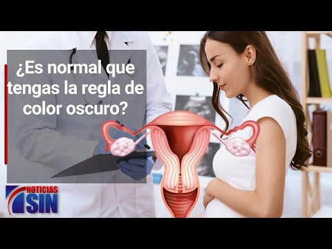 ¿Es normal que tengas la regla de color oscuro?