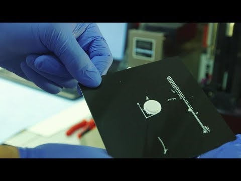 Researchers Paulo Coelho, DDS, MD, and Bruce Cronstein, MD, explain that chemically coated, ceramic implants successfully guided the regrowth of missing bone in lab animals while “steadily dissolving,” which could benefit wounded veterans and children living with skull deformations since birth. Researchers Paulo Coelho, DDS, MD, and Bruce Cronstein, MD, explain that chemically coated, ceramic implants successfully guided the regrowth of missing bone in lab animals while “steadily dissolving,” which could benefit wounded veterans and children living with skull deformations since birth.