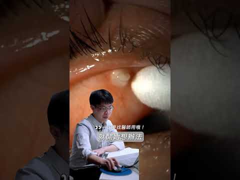 不知道這樣有療癒到大家嗎🥹但清乾淨的時候是真的很有成就感！#蕭家杰醫師 #高雄眼科醫師 #屏東眼科醫師 #大學眼科 #皮脂腺囊腫 #霰粒腫 #針眼