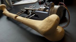 Height Improvement Surgery - Vert Shock Workout