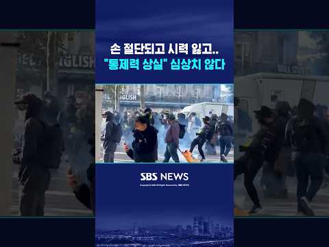 손 절단되고 시력 잃고.."통제력 상실" 심상치 않다 #shorts