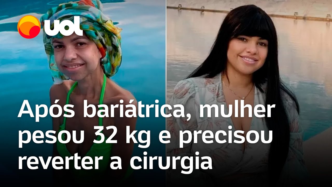 Mulher teve de reverter bariátrica após pesar 32 kg Não conseguia comer nem beber nada
