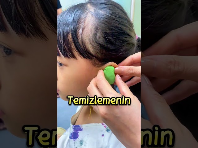 Kulağın İçinden ÇIKAN ŞEYE Hazır OL❗😱