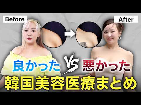 【2025年版】アラフォー韓国人の私が定期的に受けている美容医療