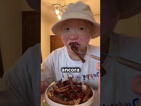 L’ha lasciata dopo l’incidente