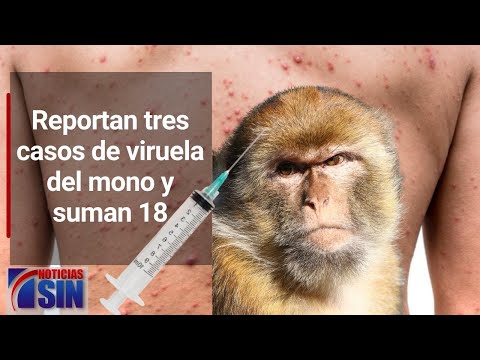 #EmisiónEstelarSIN: Viruela del mono, presupuesto y micrográfico