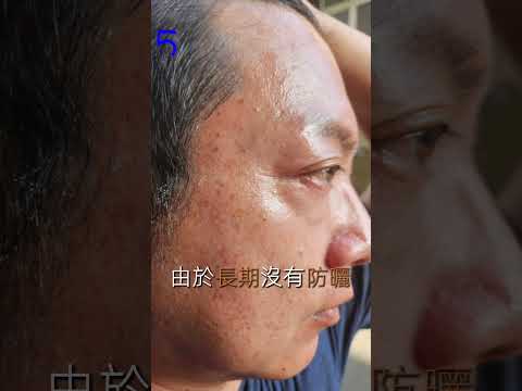 神奇淡斑聖品 #推薦 #宏寶家賀#小粉包