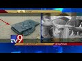 Redmi Note 4 explodes, bursts into flames in man's pocket in East Godavari