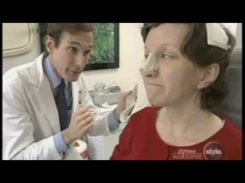 Dr Perlman Extreme Makeover Plastic Surgery Karen's Makeover - YouTube