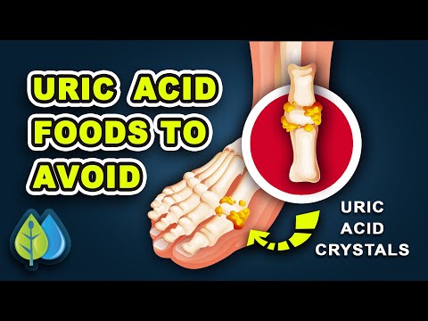 Top 10 Uric Acid Foods to Avoid (WORST for Gout)