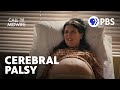 Call the Midwife | An Expectant Mother with Cerebral Palsy | Season 13 | PBS