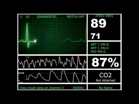 Upload mp3 to YouTube and audio cutter for Hospital Monitor with FlatLine (L) (HD) download from Youtube