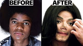 Michael Jackson Nose Job Plastic Surgeries - Surgeon Reacts