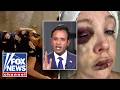 Ramaswamy sounds alarm after violent Cincinnati brawl: Not tolerating this