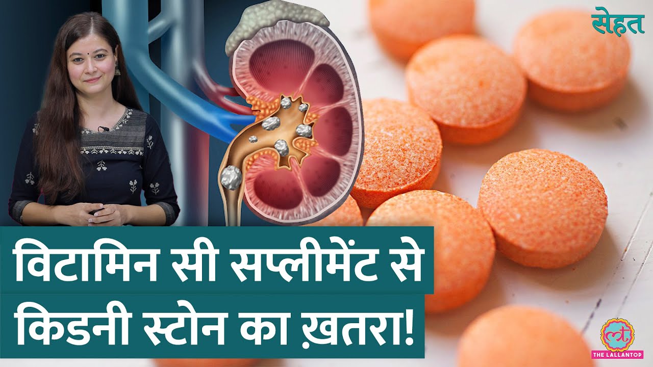 Vitamin C Supplements लेने से Kidney Stone हो सकता है? | Sehat ep 971