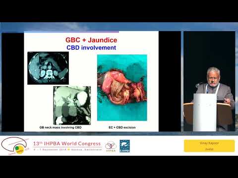 DEB11.1 Advanced Gallbladder Cancer with Jaundice: Resection: YES / NO