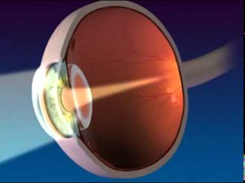Anatomy and Function of the Eye - YouTube diagram of parts of the eye 