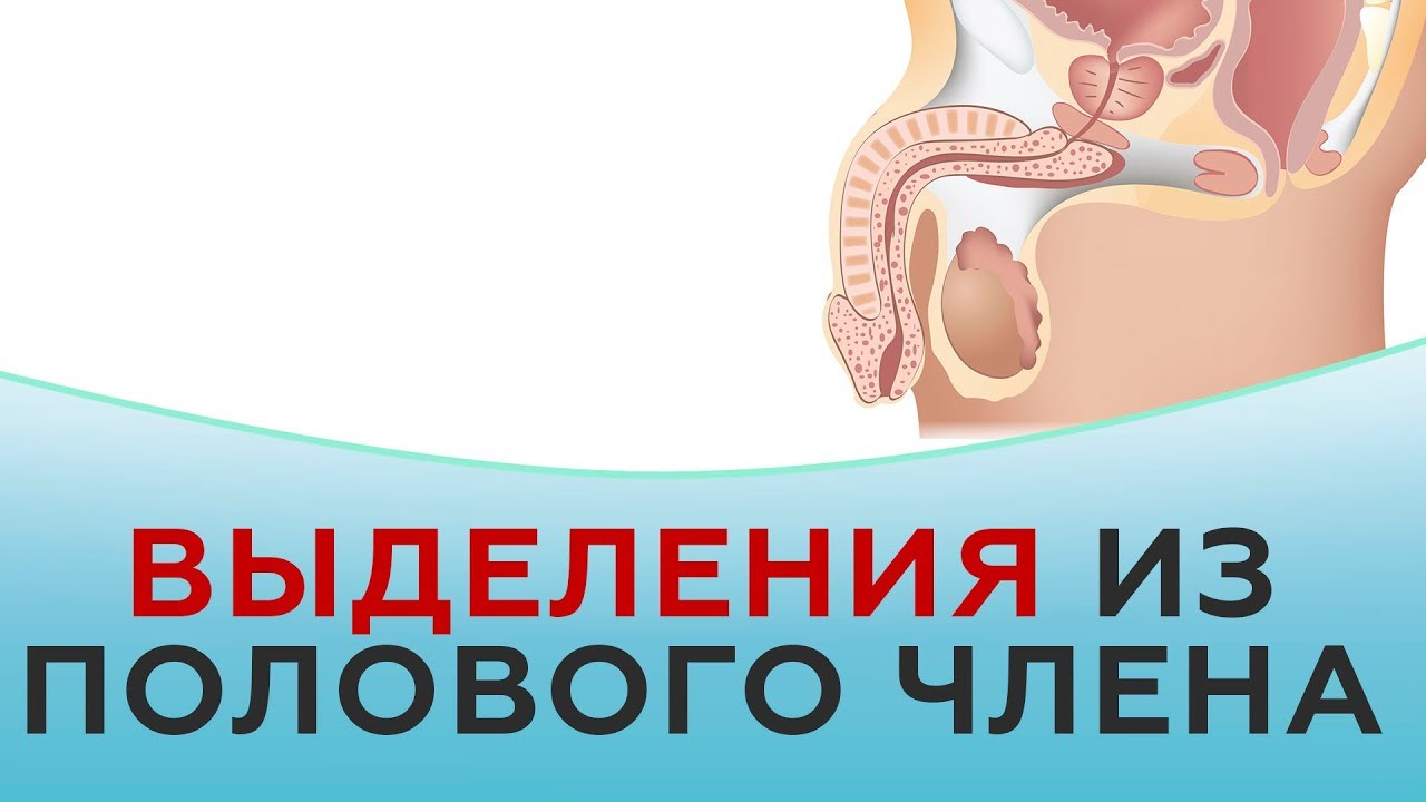 сделал Сосут по очереди Вам это