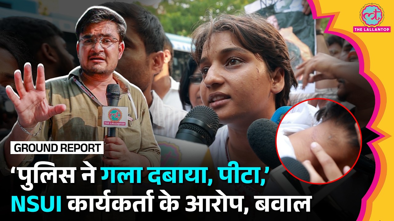 LIVE: 'बाल नोचे, मारा', NSUI कार्यकर्ता के Delhi Police पर बड़े आरोप, Lallantop कैमरे पर क्या बताया