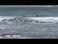 Texas shark attack survivor speaks out
