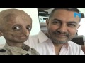 Nihal Bitla, teenage face of Progeria in India dies