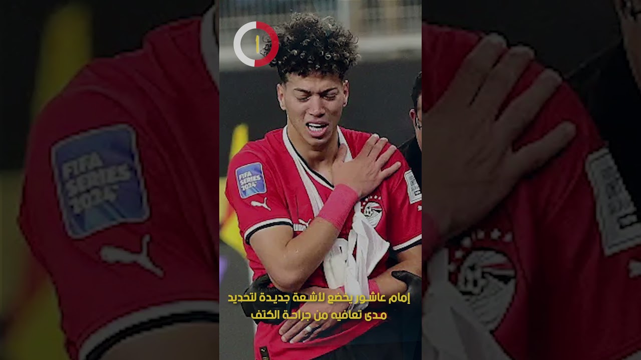 إمام عاشور يخضع لأشعة جديدة لتحديد مدى تعافيه من جراحة الكتف