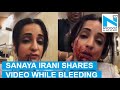 Bleeding Sanaya Irani shares   video blaming her director