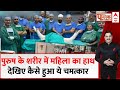 Gangaram Hospital के डॉक्टरों का चमत्कार..पुरुष के शरीर में लगाए महिला के हाथ,पूरी कहानी दंग कर देगी