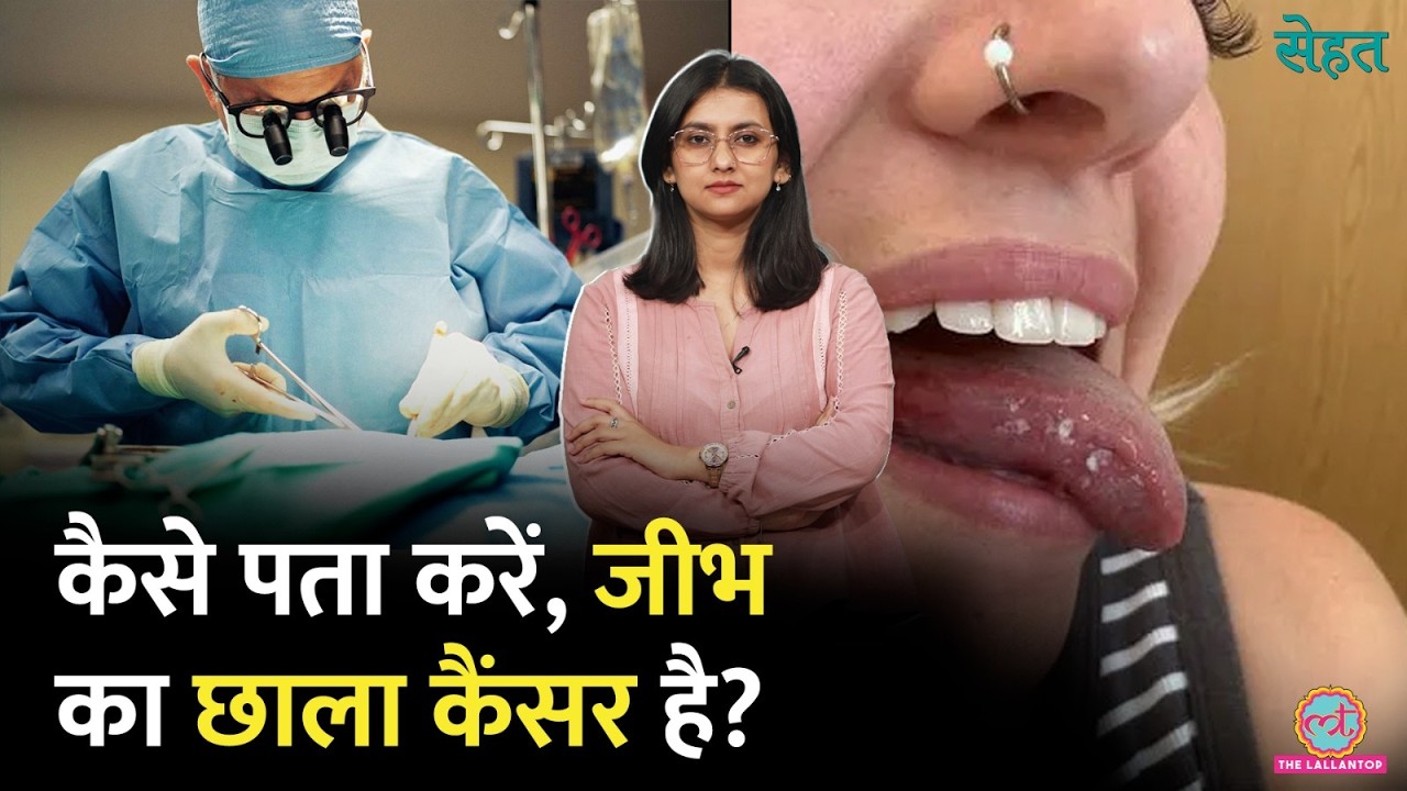 Mouth Ulcers से परेशान लड़की, Biopsy में निकला Tongue Cancer, 40% जीभ कटेगी| Sehat Ep 1385