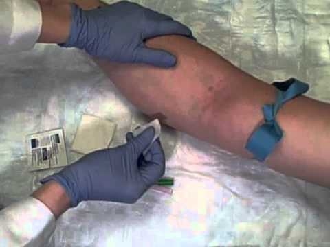 Phlebotomy on Live Patient Straight Needle - YouTube