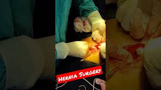 Inguinal Hernia Surgery #shorts