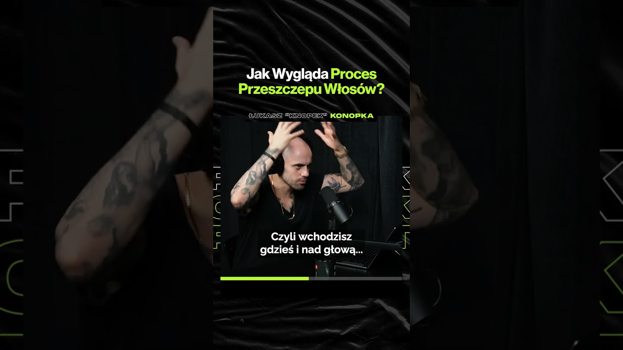 Jak Wygląda Proces Przeszczepu Włosów? – ft. Łukasz "Knopek" Konopka