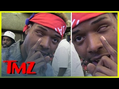 Fetty Wap -- '679' Rapper Explains How He Lost His Left Eye | TMZ